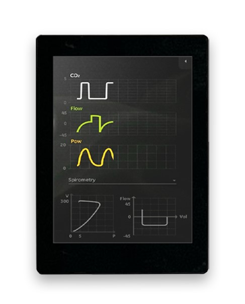 Midas MDT0280AC-USBC IPS TFT TFT LCD Display / Touch Screen, 2.8in, 480 X 640pixels