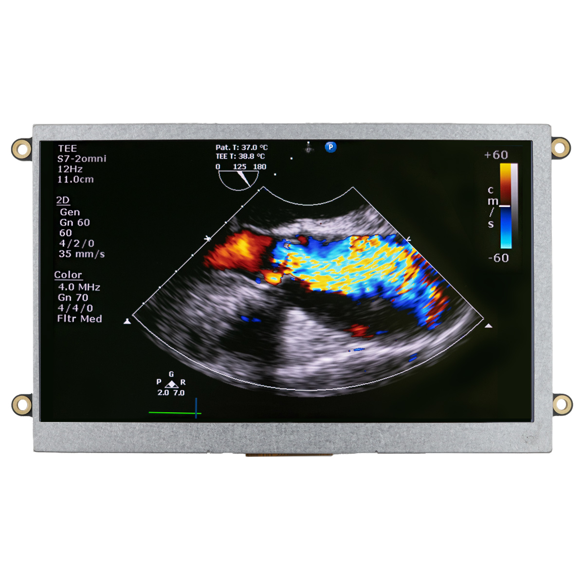 NEWHAVEN DISPLAY INTERNATIONAL NHD-7.0-HDMI-N-RSXP IPS TFT TFT LCD Display / Touch Screen, 7in, 800 x 480pixels